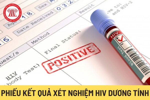 Phiếu kết quả xét nghiệm HIV dương tính