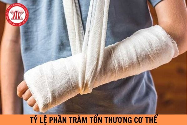 Xác định tỷ lệ phần trăm tổn thương cơ thể được tính theo phương pháp nào?