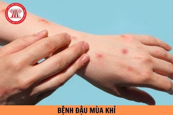 Bộ Y tế hướng dẫn 06 biện pháp phòng bệnh đậu mùa khỉ mới nhất?