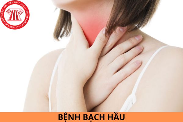 Hướng dẫn chẩn đoán, điều trị bệnh bạch hầu theo quy định của Bộ Y tế?