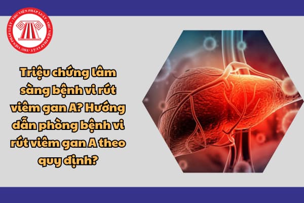 bệnh vi rút viêm gan A