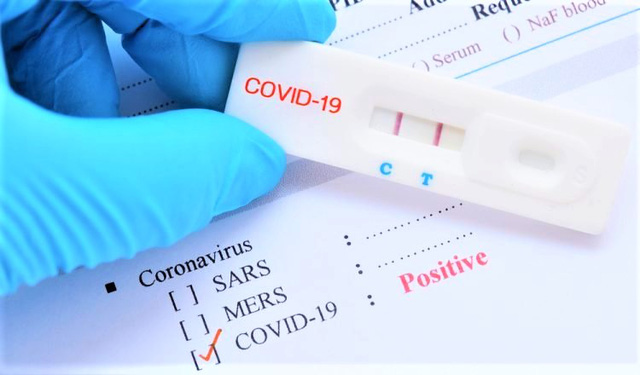 Kiểm tra đột xuất việc kinh doanh kit test nhanh và xét nghiệm RT-PCR