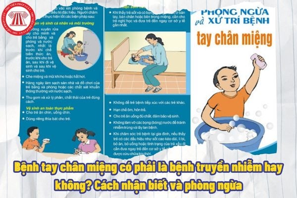 Bệnh tay chân miệng có phải là bệnh truyền nhiễm hay không? Cách nhận biết và phòng ngừa khi bị bệnh tay chân miệng?