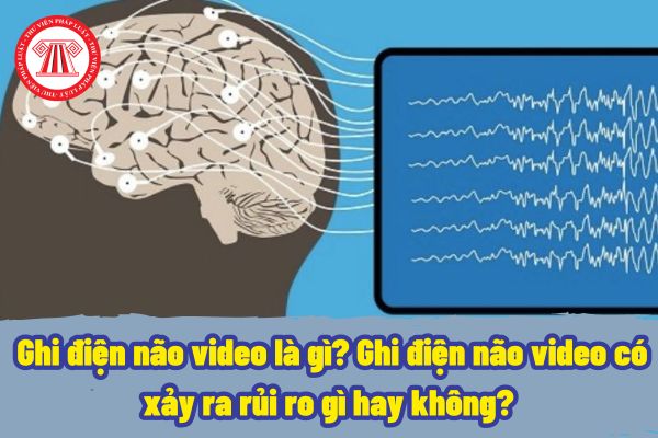 Ghi điện não video là gì? Ghi điện não video có xảy ra rủi ro gì hay không? Quy trình thực hiện ghi điện não video sẽ như thế nào?