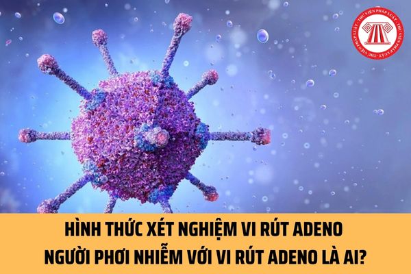 Xét nghiệm vi rút Adeno có bao nhiêu hình thức? Người được gọi là phơi nhiễm với vi rút adeno khi nào?