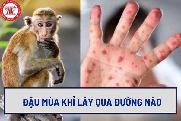 Đậu mùa khỉ lây qua đường nào? Hướng dẫn điều trị bệnh đậu mùa khỉ ở người mới nhất như thế nào?