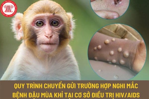 Quy trình chuyển gửi trường hợp nghi mắc bệnh đậu mùa khỉ tại cơ sở điều trị HIV/AIDS và PrEP được thực hiện như thế nào?