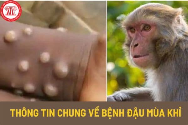 Thông tin chung về bệnh Đậu mùa khỉ hiện nay thế nào? Biện pháp phòng ngừa bệnh đậu mùa khỉ ra sao?