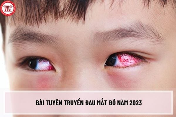 Bài tuyên truyền đau mắt đỏ năm 2023 chi tiết nhất? Cách phòng bệnh đau mắt đỏ theo khuyến cáo Bộ Y tế?