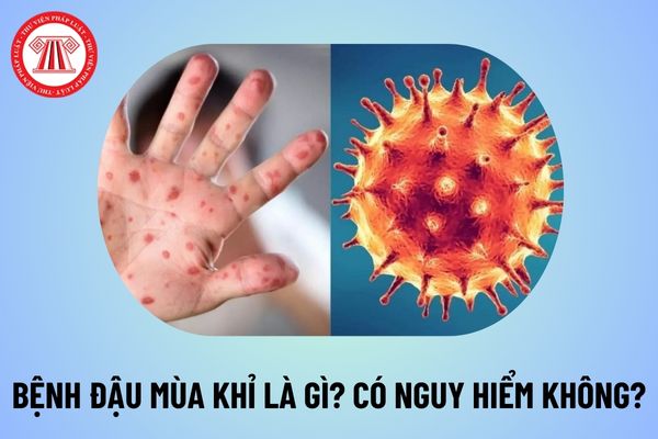 Đậu mùa khỉ là gì? Bệnh đậu mùa khỉ lây qua đường nào? Bệnh đậu mùa khỉ có nguy hiểm không?