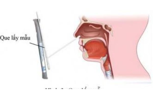 Mẫu ngoáy dịch mũi