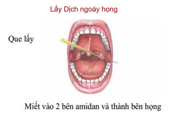 lấy mẫu