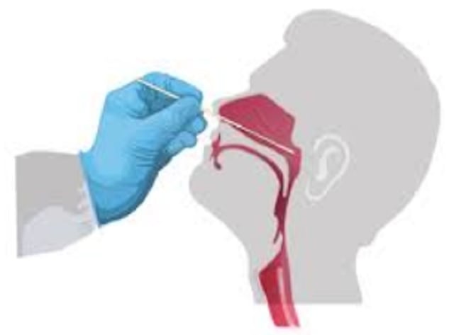 Hướng dẫn các bước test COVID nhanh tại nhà đơn giản?