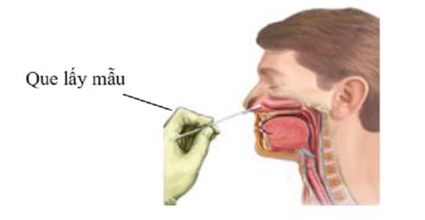 Hướng dẫn các bước test COVID nhanh tại nhà đơn giản?