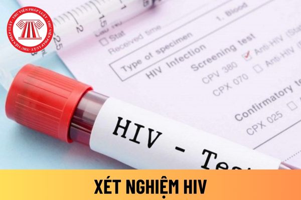 Xét nghiệm HIV