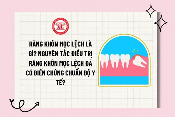 Răng khôn mọc lệch là gì? Nguyên tắc điều trị răng khôn mọc lệch đã có biến chứng chuẩn Bộ Y tế?