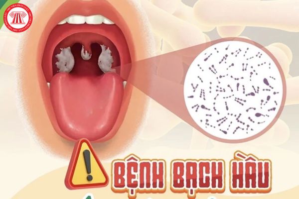 Bao nhiêu tuổi dễ mắc bệnh bạch hầu? Vi khuẩn gây bệnh bạch hầu có sống trên đồ chơi của trẻ em?