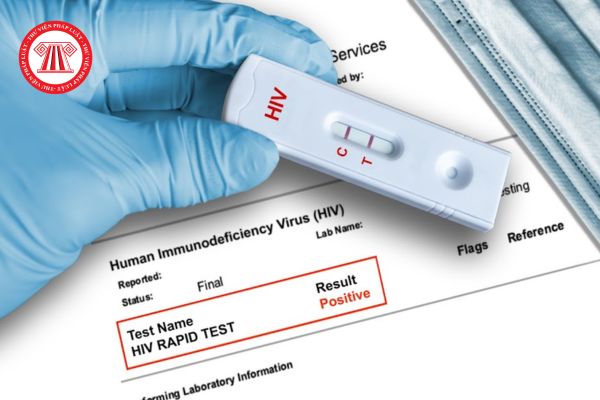 xét nghiệm HIV dương tính