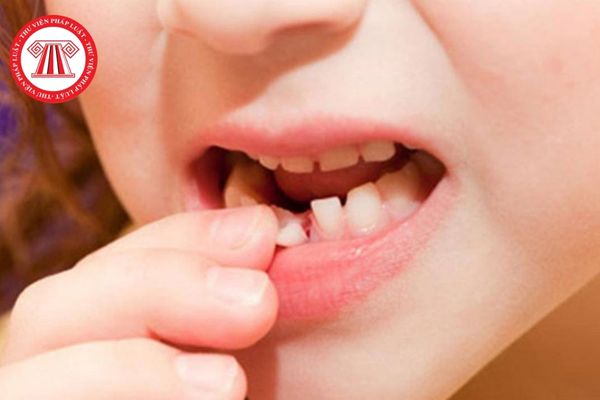 Phục hồi thân răng