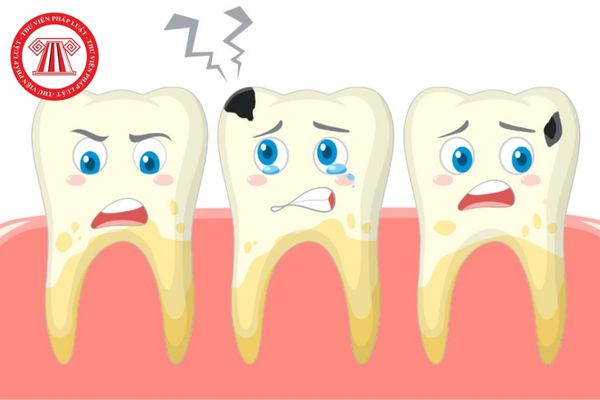 Thực hiện điều trị tổn thương bệnh sâu răng sớm như thế nào? Những yếu tố  nào làm tăng khả năng sâu răng?