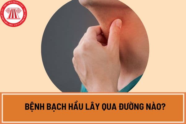 Bệnh bạch hầu lây qua đường nào? 