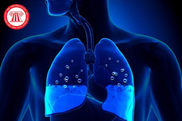 Người nghi mắc bệnh lao phổi khi có các triệu chứng nào? Những nhóm có nguy cơ cao mắc lao phổi?
