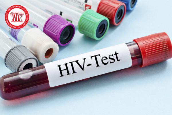 Khi tự xét nghiệm HIV tại nhà có thể yêu cầu trợ giúp của nhân viên xét nghiệm không? Tổ chức hình thức tự xét nghiệm HIV ra sao?
