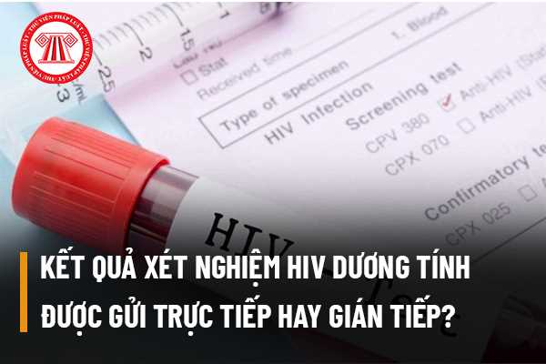 Xét nghiệm HIV﻿