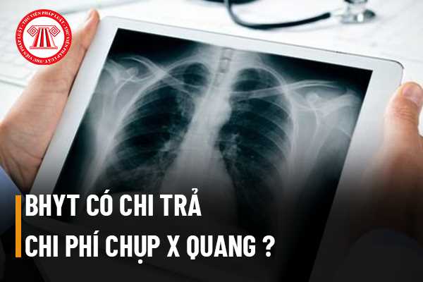 Chụp X Quang Có Bảo Hiểm Bao Nhiêu Tiền - Thông Tin Chi Tiết Và Quy Định Mới Nhất