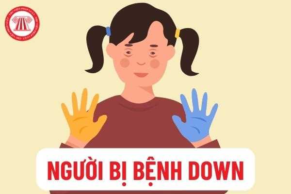 Cách điều trị cho bệnh nhân bị down 