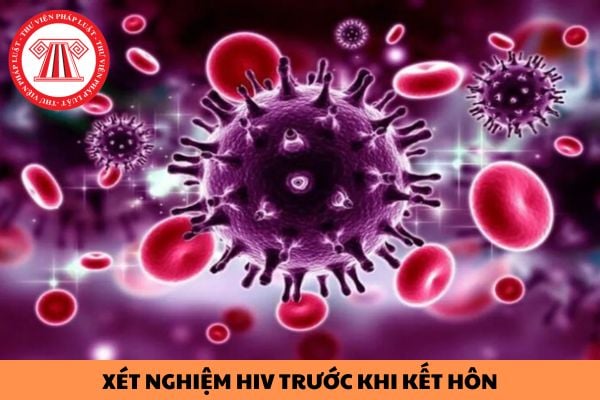 Có bắt buộc phải xét nghiệm HIV trước khi kết hôn hay không?