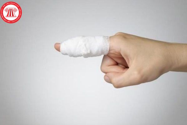 Tỷ lệ phần trăm tổn thương cơ thể do tổn thương ngón tay được quy định như thế nào?