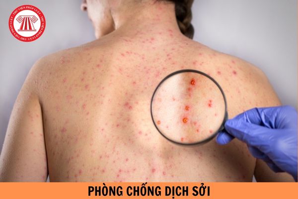 Thời gian, đối tượng, phạm vi triển khai chiến dịch tiêm chủng vắc xin phòng chống dịch Sởi năm 2024 mới nhất?