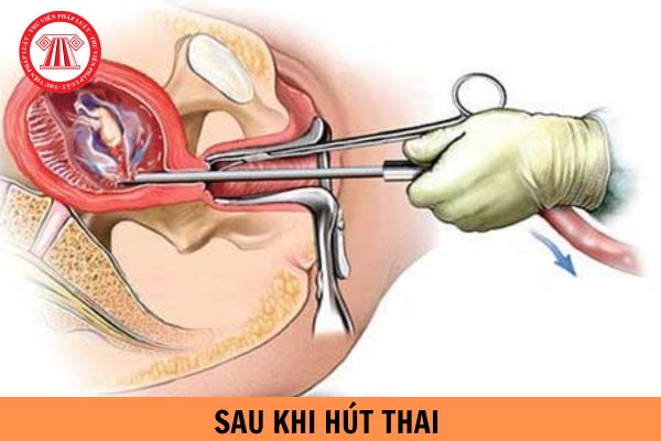 Năm 2024, thời gian lao động nữ hưởng chế độ thai sản sau khi hút thai là bao nhiêu ngày?