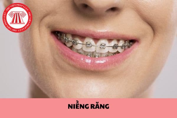 Thanh niên đang niềng răng có được miễn nghĩa vụ quân sự không? Tạm hoãn đi nghĩa vụ quân sự trong trường hợp nào?