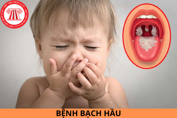 Dấu hiệu nhận biết bệnh bạch hầu ở trẻ em: Triệu chứng, chẩn đoán và cách phòng ngừa