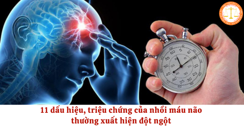 11 dấu hiệu, triệu chứng của nhồi máu não thường xuất hiện đột ngột theo hướng dẫn chẩn đoán của Bộ Y tế