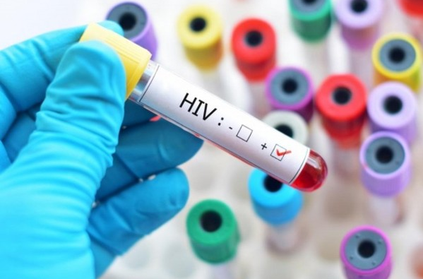 Người nhiễm HIV phải thông báo cho người chung sống như vợ chồng với mình