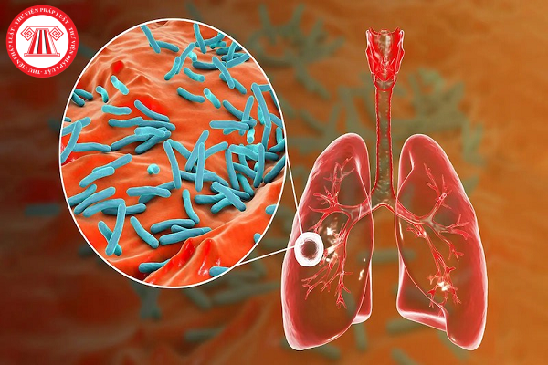 Năm 2024, mắc bệnh lao phổi có được hưởng BHXH một lần?