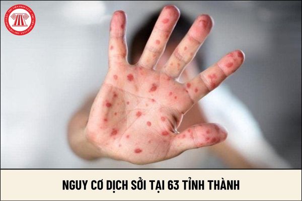 Nguy cơ dịch Sởi tại 63 tỉnh thành?