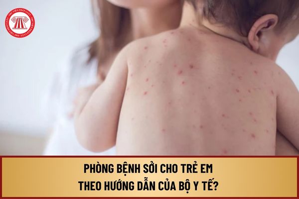 Cách phòng bệnh sởi cho trẻ em theo hướng dẫn của Bộ Y tế? Cách chữa bệnh sởi được thực hiện ra sao?