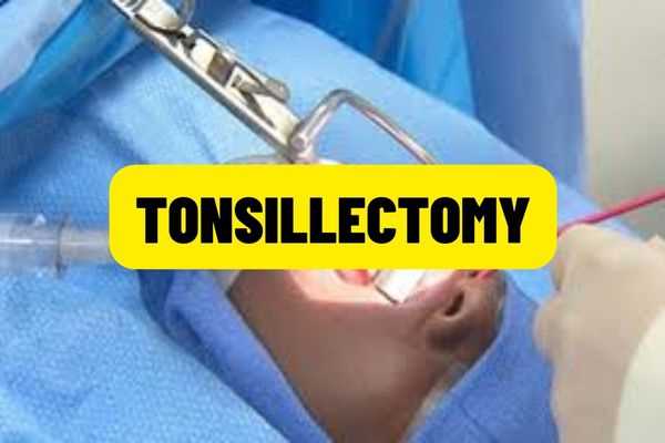 Is tonsillectomy in Vietnam a type of surgery covered by health insurance? What is the remaining cost that the patient has to pay?