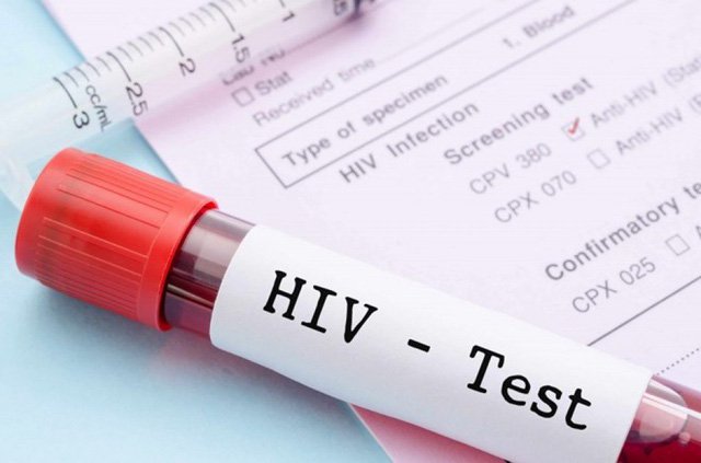 Ai được thông báo kết quả xét nghiệm HIV dương tính?