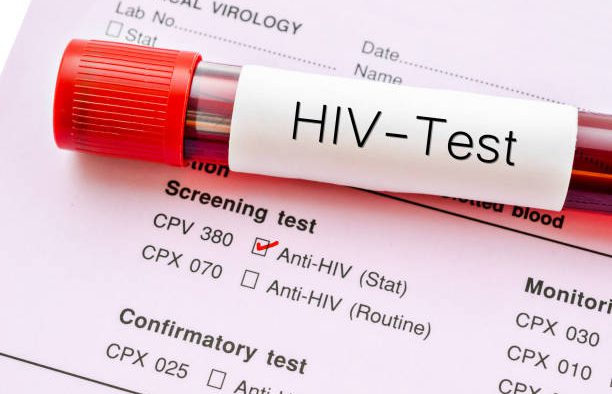 Các trường hợp xét nghiệm HIV bắt buộc