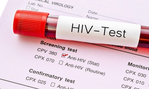 Chú trọng xét nghiệm HIV cho người quan hệ đồng giới trong công tác phòng chống HIV/AIDS năm 2024