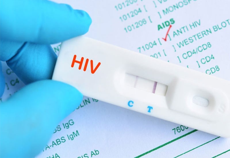 Những ai được biết kết quả nhiễm HIV của người khác?