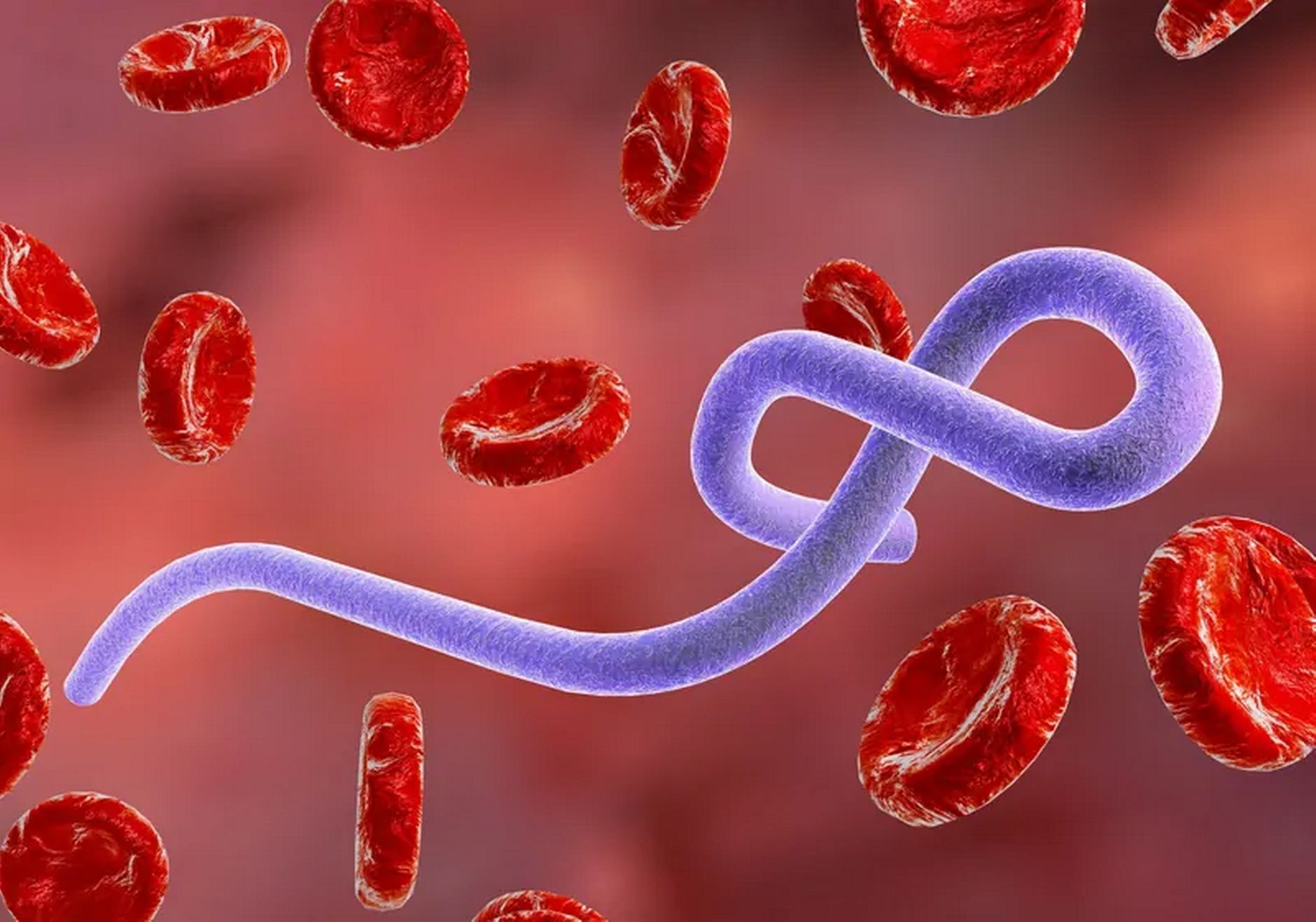 Hướng dẫn phòng ngừa lây nhiễm virus Ebola